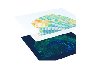 Visium Spatial Gene Expression Solution